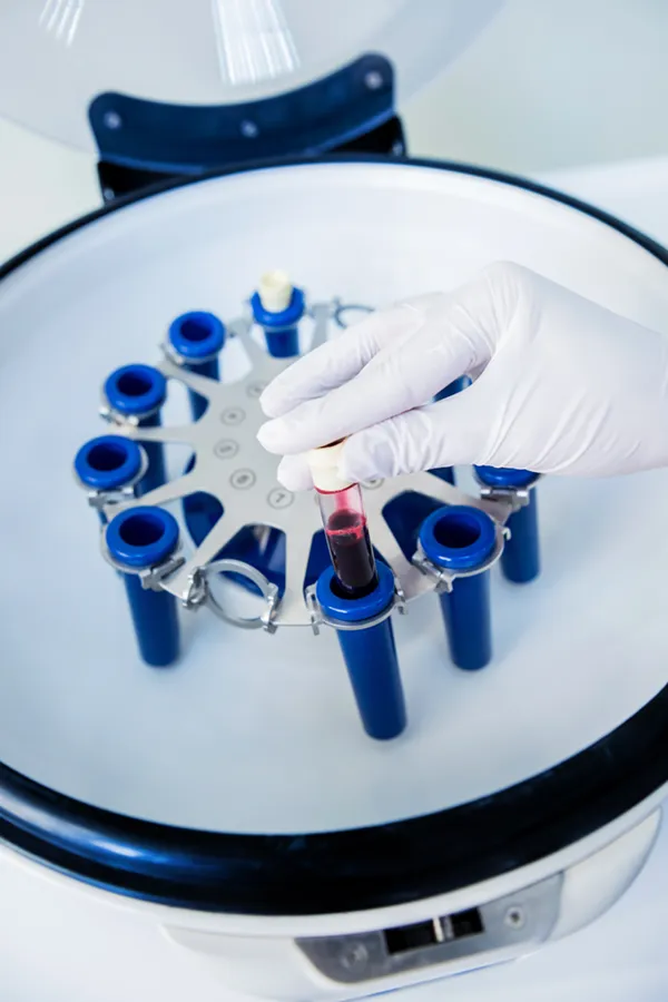 A blood centrifuge. Get Iron Metabolism testing from Morgan Burns, APRN in Central Florida.