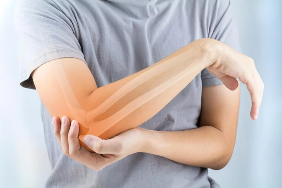 A close-up of a woman holding her elbow with an illustration of the bones and joint experiencing pain from osteoporosis. Get osteoporosis treatment from Frank Lanzisera, D.C. in Tampa Bay Metro.