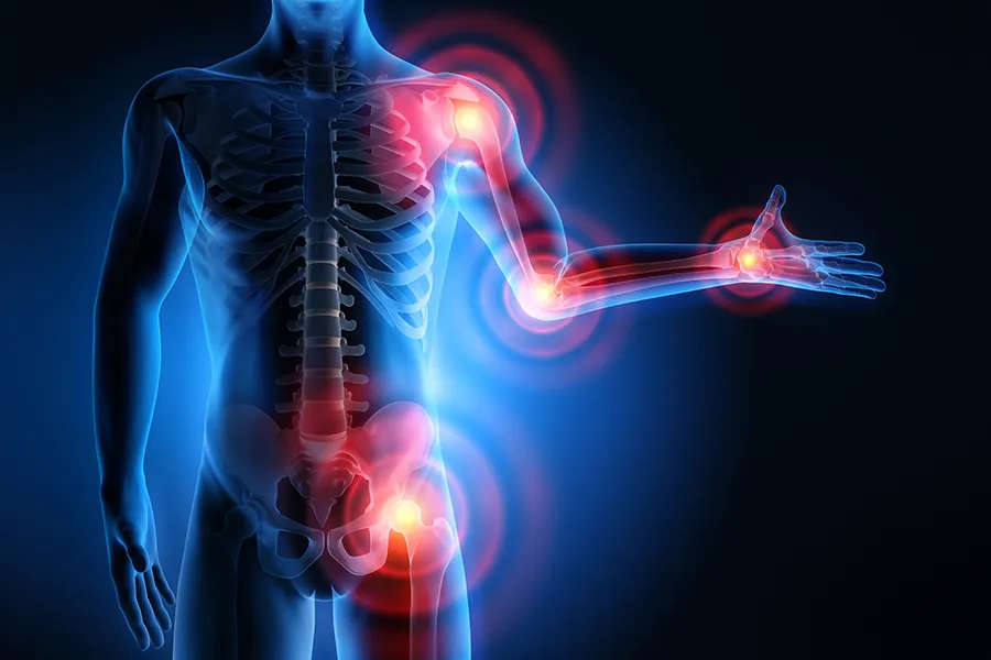 3D illustration of a human body under x-ray, with highlights on the joints. Get regenerative medicine for joint pain from Frank Lanzisera, D.C. in Tampa Bay Metro.