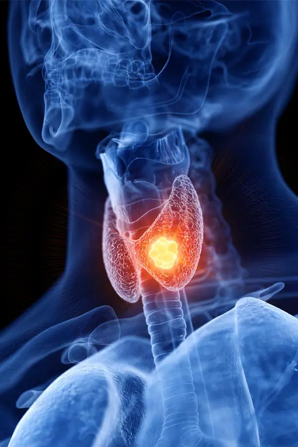 A 3D illustration of an x-ray of a human neck, highlighting the thyroid. Get help with thyroid imbalance from Frank Lanzisera, D.C. in Tampa Bay Metro.